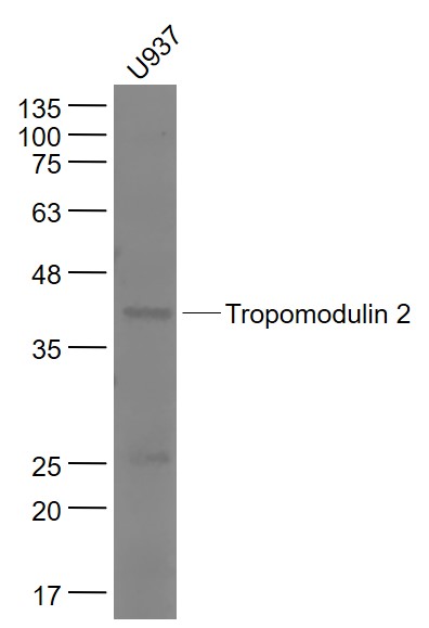 U937 cell lysates probed with Tropomodulin 2 Polyclonal Antibody, Unconjugated (bs-17155R) at 1:1000 dilution and 4˚C overnight incubation. Followed by conjugated secondary antibody incubation at 1:20000 for 60 min at 37˚C.