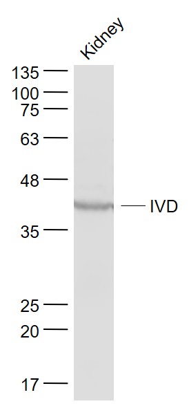 Mouse kidney lysates probed with IVD Polyclonal Antibody, Unconjugated (bs-17189R) at 1:1000 dilution and 4˚C overnight incubation. Followed by conjugated secondary antibody incubation at 1:20000 for 60 min at 37˚C.