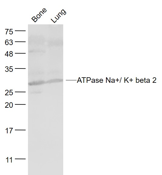 Lane 1: Mouse bone lysates; Lane 2:Mouse lung lysates probed with ATPase Na+/ K+ beta 2 Polyclonal Antibody, Unconjugated (bs-23414R) at 1:1000 dilution and 4˚C overnight incubation. Followed by conjugated secondary antibody incubation at 1:20000 for 60 min at 37˚C.