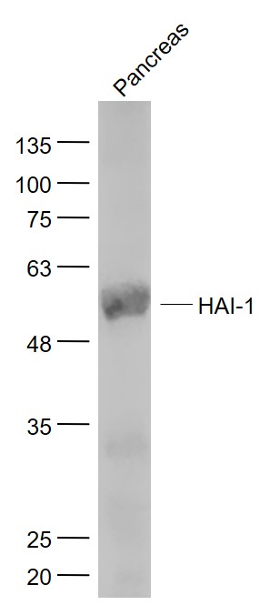 Mouse pancreas lysates probed with HAI-1 Polyclonal Antibody, Unconjugated (bs-0540R) at 1:1000 dilution and 4˚C overnight incubation. Followed by conjugated secondary antibody incubation at 1:20000 for 60 min at 37˚C.