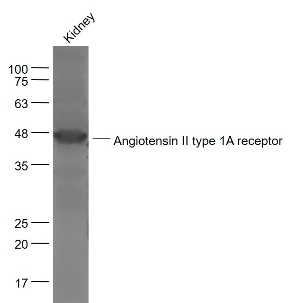 Mouse kidney lysates probed with Angiotensin 2 type 1A receptor Polyclonal Antibody, Unconjugated (bs-2132R) at 1:1000 dilution and 4˚C overnight incubation. Followed by conjugated secondary antibody incubation at 1:20000 for 60 min at 37˚C.