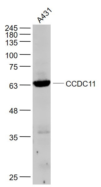 A431 cell lysates probed with CCDC11 Polyclonal Antibody, Unconjugated (bs-7740R) at 1:1000 dilution and 4˚C overnight incubation. Followed by conjugated secondary antibody incubation at 1:20000 for 60 min at 37˚C.