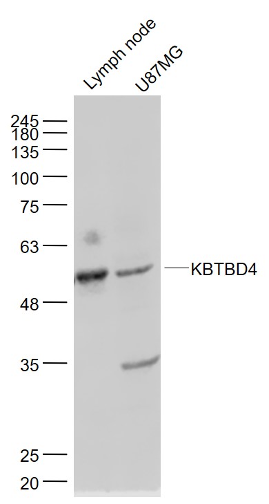 Lane 1: Mouse lymph node lysates; Lane 2: U87MG cell lysates probed with KBTBD4 Polyclonal Antibody, Unconjugated (bs-8045R) at 1:1000 dilution and 4˚C overnight incubation. Followed by conjugated secondary antibody incubation at 1:20000 for 60 min at 37˚C.