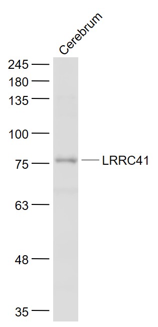 Mouse cerebrum lysates probed with LRRC41 Polyclonal Antibody, Unconjugated (bs-8362R) at 1:1000 dilution and 4˚C overnight incubation. Followed by conjugated secondary antibody incubation at 1:20000 for 60 min at 37˚C.