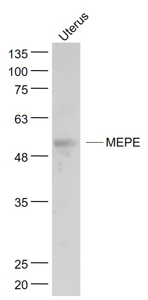 Mouse uterus lysates probed with MEPE Polyclonal Antibody, Unconjugated (bs-8689R) at 1:1000 dilution and 4˚C overnight incubation. Followed by conjugated secondary antibody incubation at 1:20000 for 60 min at 37˚C.