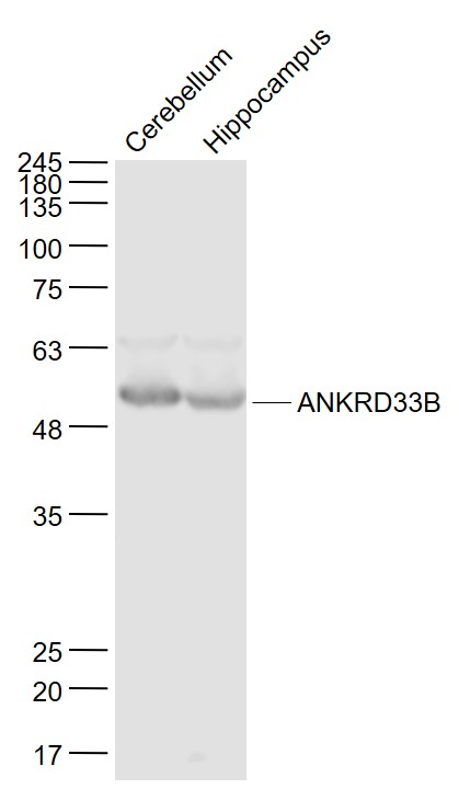 Lane 1: mouse erebellum lysates; Lane 2: mouse hippocampus lysates probed with ANKRD33B Polyclonal Antibody, Unconjugated (bs-9397R) at 1:1000 dilution and 4˚C overnight incubation. Followed by conjugated secondary antibody incubation at 1:20000 for 60 min at 37˚C.