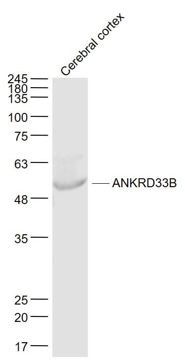 Rat cerebral cortex lysates probed with ANKRD33B Polyclonal Antibody, Unconjugated (bs-9397R) at 1:1000 dilution and 4˚C overnight incubation. Followed by conjugated secondary antibody incubation at 1:20000 for 60 min at 37˚C.