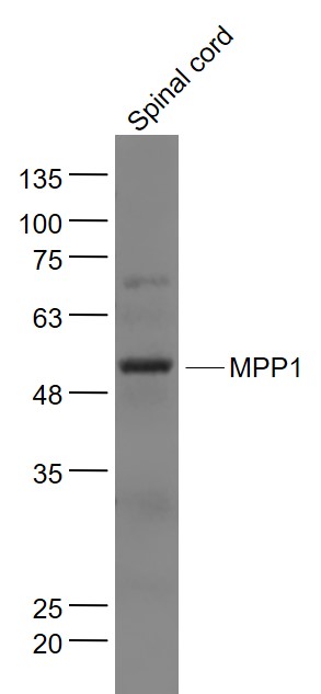 Mouse spinal cord lysates probed with MPP1 Polyclonal Antibody, Unconjugated (bs-9522R) at 1:1000 dilution and 4˚C overnight incubation. Followed by conjugated secondary antibody incubation at 1:20000 for 60 min at 37˚C.