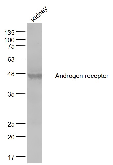 Mouse kidney lysates probed with Androgen receptor Polyclonal Antibody, Unconjugated (bs-0118R) at 1:1000 dilution and 4˚C overnight incubation. Followed by conjugated secondary antibody incubation at 1:20000 for 60 min at 37˚C.