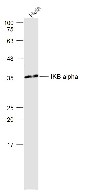 Hela lysates probed with NFKBIA\/IKB alpha Polyclonal Antibody, Unconjugated (bs-1287R) at 1:1000 dilution and 4˚C overnight incubation. Followed by conjugated secondary antibody incubation at 1:20000 for 60 min at 37˚C.