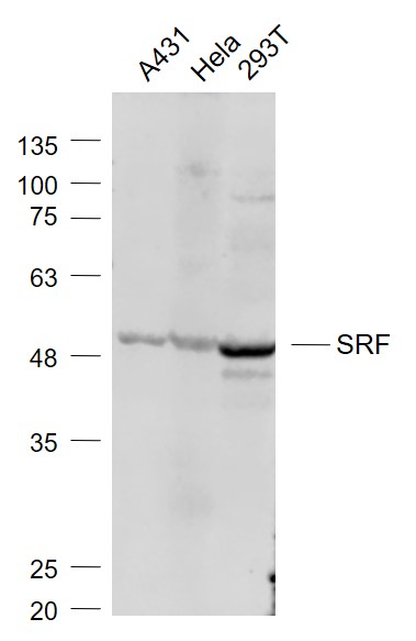 Lane 1: A431 cell lysates; Lane 2: Hela cell lysates; Lane 3: 293T cell lysates probed with SRF Polyclonal Antibody, Unconjugated (bs-1401R) at 1:1000 dilution and 4˚C overnight incubation. Followed by conjugated secondary antibody incubation at 1:20000 for 60 min at 37˚C