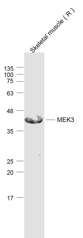 Lane 1: rat skeletal muscle lysates probed with MEK3/MAP2K3 Polyclonal Antibody, Unconjugated (bs-1689R) at 1:1000 dilution and 4˚C overnight incubation. Followed by conjugated secondary antibody incubation at 1:20000 for 60 min at 37˚C.