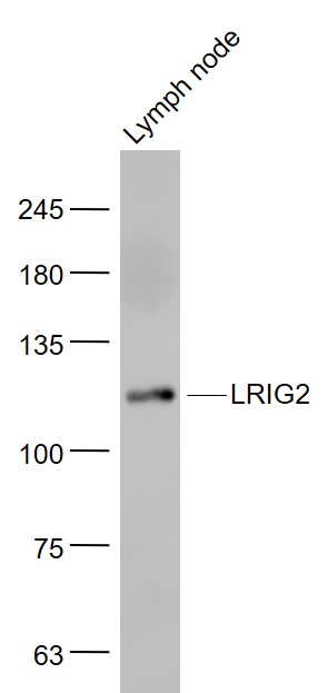 Mouse lymph node lysates probed with LRIG2 Polyclonal Antibody, Unconjugated (bs-1845R) at 1:1000 dilution and 4˚C overnight incubation. Followed by conjugated secondary antibody incubation at 1:20000 for 60 min at 37˚C.