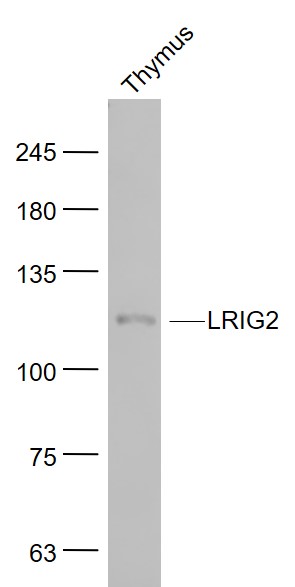Mouse thymus lysates probed with LRIG2 Polyclonal Antibody, Unconjugated (bs-1845R) at 1:1000 dilution and 4˚C overnight incubation. Followed by conjugated secondary antibody incubation at 1:20000 for 60 min at 37˚C.