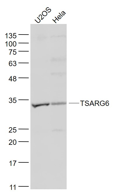 Lane 1: U2os cell lysates; Lane 2: Hela cell lysates probed with TSARG6/DNAJB13 Polyclonal Antibody, Unconjugated (bs-1923R) at 1:1000 dilution and 4˚C overnight incubation. Followed by conjugated secondary antibody incubation at 1:20000 for 60 min at 37˚C.