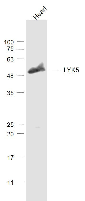 Mouse heart lysates probed with LYK5 Polyclonal Antibody, Unconjugated (bs-3949R) at 1:1000 dilution and 4˚C overnight incubation. Followed by conjugated secondary antibody incubation at 1:20000 for 60 min at 37˚C.