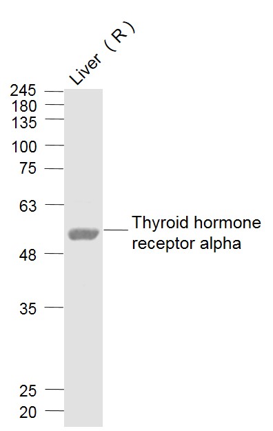 Rat liver lysates probed with Thyroid Hormone Receptor Polyclonal Antibody, Unconjugated (bs-6221R) at 1:1000 dilution and 4˚C overnight incubation. Followed by conjugated secondary antibody incubation at 1:20000 for 60 min at 37˚C.