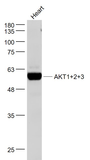 Mouse heart lysates probed with AKT1+2+3 Polyclonal Antibody, Unconjugated (bs-6951R) at 1:1000 dilution and 4˚C overnight incubation. Followed by conjugated secondary antibody incubation at 1:20000 for 60 min at 37˚C.