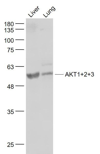 Lane 1: Mouse Liver lysates; Lane 2: Mouse Lung lysates probed with AKT1+2+3 Polyclonal Antibody, Unconjugated (bs-6951R) at 1:1000 dilution and 4˚C overnight incubation. Followed by conjugated secondary antibody incubation at 1:20000 for 60 min at 37˚C.