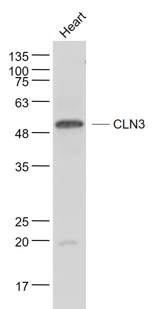 Mouse heart lysates probed with CLN3 Polyclonal Antibody, Unconjugated (bs-8016R) at 1:1000 dilution and 4˚C overnight incubation. Followed by conjugated secondary antibody incubation at 1:20000 for 60 min at 37˚C.