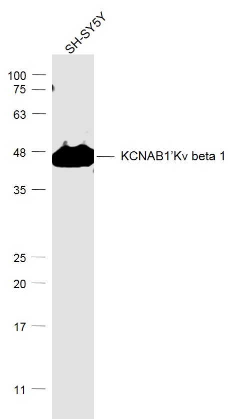 SH-SY5Y cell lysates probed with KCNAB1 Polyclonal Antibody, Unconjugated (bs-8691R) at 1:1000 dilution and 4˚C overnight incubation. Followed by conjugated secondary antibody incubation at 1:20000 for 60 min at 37˚C.