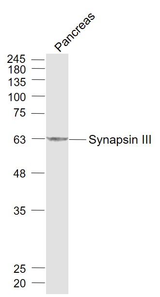 Mouse pancreas lysates probed with Synapsin 3 Polyclonal Antibody, Unconjugated (bs-11371R) at 1:1000 dilution and 4˚C overnight incubation. Followed by conjugated secondary antibody incubation at 1:20000 for 60 min at 37˚C.