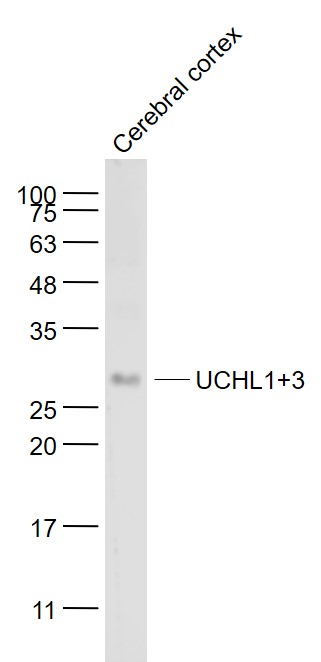 Mouse cerebral cortex lysates probed with UCHL1+3 Polyclonal Antibody, Unconjugated (bs-11677R) at 1:1000 dilution and 4˚C overnight incubation. Followed by conjugated secondary antibody incubation at 1:20000 for 60 min at 37˚C.