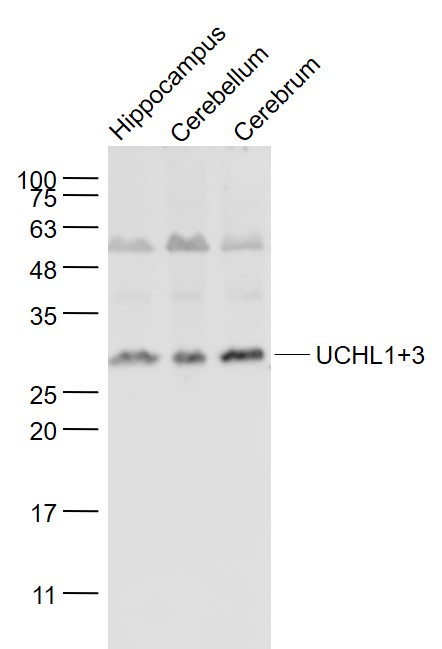 Lane 1: Mouse Hippocampus lysates; Lane 2: Mouse Cerebellum lysates; Lane 3: Mouse Cerebrum lysates probed with UCHL1+3 Polyclonal Antibody, Unconjugated (bs-11677R) at 1:1000 dilution and 4˚C overnight incubation. Followed by conjugated secondary antibody incubation at 1:20000 for 60 min at 37˚C.