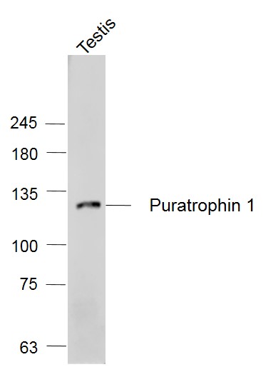 Mouse testis lysates probed with Puratrophin 1/PLEKHG4 Polyclonal Antibody, Unconjugated (bs-11747R) at 1:1000 dilution and 4˚C overnight incubation. Followed by conjugated secondary antibody incubation at 1:20000 for 60 min at 37˚C.