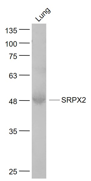 Mouse lung lysates probed with SRPX2 Polyclonal Antibody, Unconjugated (bs-11967R) at 1:1000 dilution and 4˚C overnight incubation. Followed by conjugated secondary antibody incubation at 1:20000 for 60 min at 37˚C.