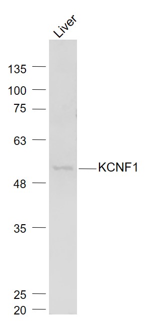 Mouse liver lysates probed with KCNF1 Polyclonal Antibody, Unconjugated (bs-12173R) at 1:1000 dilution and 4˚C overnight incubation. Followed by conjugated secondary antibody incubation at 1:20000 for 60 min at 37˚C.