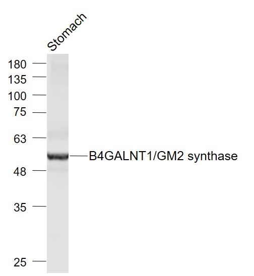 Mouse stomach lysates probed with B4GALNT1/GM2 synthase Polyclonal Antibody, Unconjugated (bs-12706R) at 1:1000 dilution and 4˚C overnight incubation. Followed by conjugated secondary antibody incubation at 1:20000 for 60 min at 37˚C.