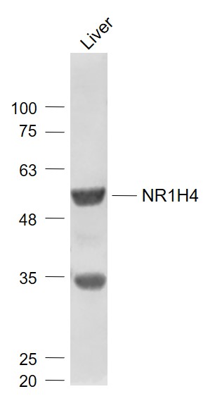Mouse liver lysates probed with Bile Acid Receptor NR1H4 Polyclonal Antibody, Unconjugated (bs-12867R) at 1:1000 dilution and 4˚C overnight incubation. Followed by conjugated secondary antibody incubation at 1:20000 for 60 min at 37˚C.