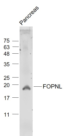 Mouse pancreas lysates probed with FOPNL/C16orf63 Polyclonal Antibody, Unconjugated (bs-13197R) at 1:1000 dilution and 4˚C overnight incubation. Followed by conjugated secondary antibody incubation at 1:20000 for 60 min at 37˚C.