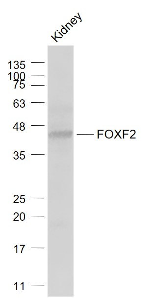 Mouse kidney lysates probed with FOXF2 Polyclonal Antibody, Unconjugated (bs-13201R) at 1:1000 dilution and 4˚C overnight incubation. Followed by conjugated secondary antibody incubation at 1:20000 for 60 min at 37˚C.