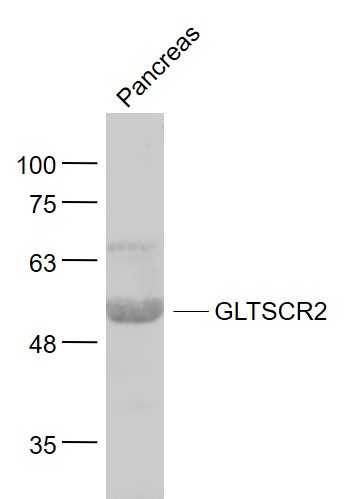 Mouse pancreas lysates probed with GLTSCR2/PICT1 Polyclonal Antibody, Unconjugated (bs-13382R) at 1:1000 dilution and 4˚C overnight incubation. Followed by conjugated secondary antibody incubation at 1:20000 for 60 min at 37˚C.