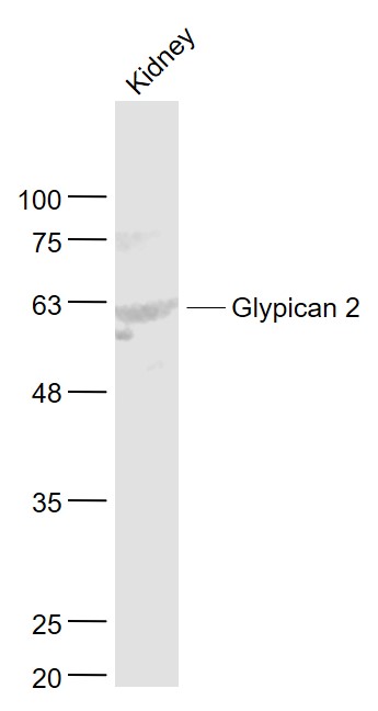 Mouse kidney lysates probed with Glypican 2/GPC2 Polyclonal Antibody, Unconjugated (bs-13450R) at 1:1000 dilution and 4˚C overnight incubation. Followed by conjugated secondary antibody incubation at 1:20000 for 60 min at 37˚C.