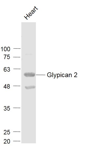 Mouse heart lysates probed with Glypican 2/GPC2 Polyclonal Antibody, Unconjugated (bs-13450R) at 1:1000 dilution and 4˚C overnight incubation. Followed by conjugated secondary antibody incubation at 1:20000 for 60 min at 37˚C.