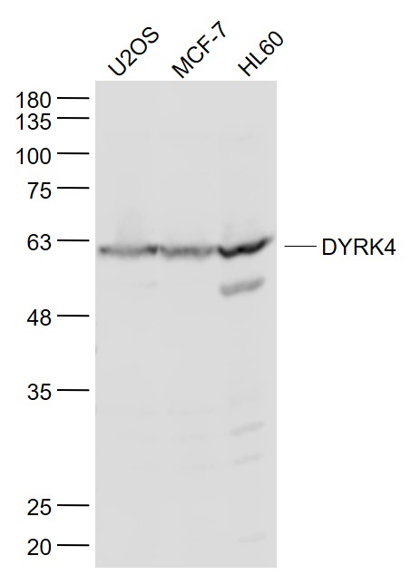Lane 1: U2os cell lysates; Lane 2: MCF-7 cell lysates; Lane 3: HL60 cell lysates probed with DYRK4 Polyclonal Antibody, Unconjugated (bs14474R) at 1:1000 dilution and 4˚C overnight incubation. Followed by conjugated secondary antibody incubation at 1:20000 for 60 min at 37˚C.