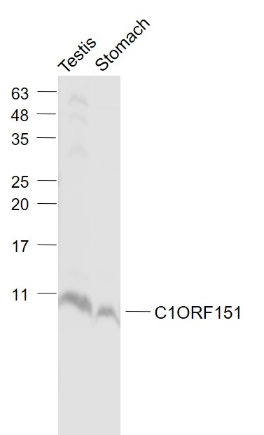 Lane 1: Mouse Testis lysates; Lane 2: Mouse Stomach lysates probed with C1ORF151 Polyclonal Antibody, Unconjugated (bs-15029R) at 1:1000 dilution and 4˚C overnight incubation. Followed by conjugated secondary antibody incubation at 1:20000 for 60 min at 37˚C.