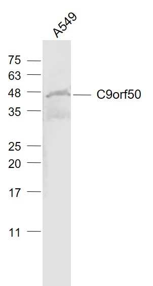 A549 cell lysates probed with C9orf50 Polyclonal Antibody, Unconjugated (bs-15331R) at 1:1000 dilution and 4˚C overnight incubation. Followed by conjugated secondary antibody incubation at 1:20000 for 60 min at 37˚C.