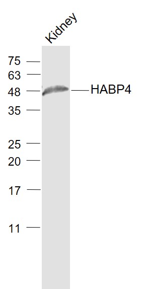 Mouse kidney lysates probed with HABP4 Polyclonal Antibody, Unconjugated (bs-15402R) at 1:1000 dilution and 4˚C overnight incubation. Followed by conjugated secondary antibody incubation at 1:20000 for 60 min at 37˚C.