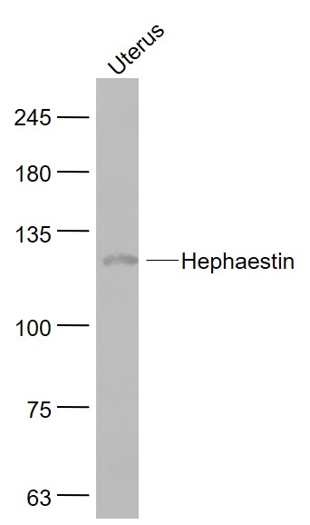 Mouse uterus lysates probed with Hephaestin Polyclonal Antibody, Unconjugated (bs-15458R) at 1:1000 dilution and 4˚C overnight incubation. Followed by conjugated secondary antibody incubation at 1:20000 for 60 min at 37˚C.