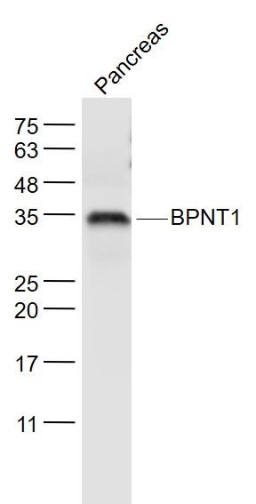 Mouse pancreas lysates probed with BPNT1 Polyclonal Antibody, Unconjugated (bs-20136R) at 1:1000 dilution and 4˚C overnight incubation. Followed by conjugated secondary antibody incubation at 1:20000 for 60 min at 37˚C.