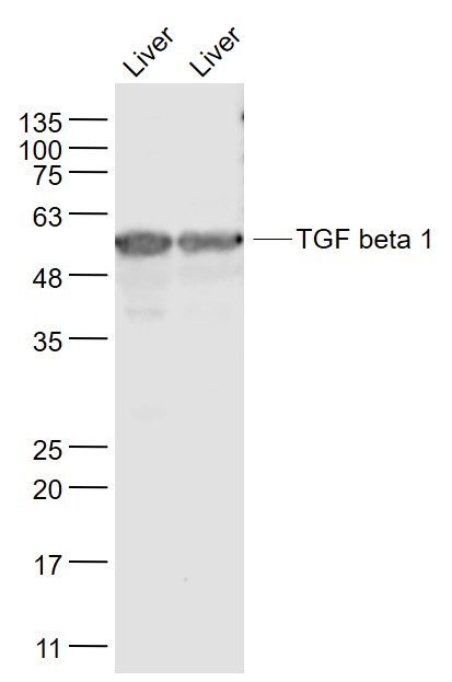 Lane 1: Mouse Liver lysates; Lane 2: Rat Liver lysates probed with TGF beta 1 Polyclonal Antibody, Unconjugated (bs-0086R) at 1:1000 dilution and 4˚C overnight incubation. Followed by conjugated secondary antibody incubation at 1:20000 for 60 min at 37˚C.