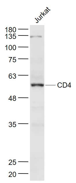 Lane 1: Jurkat cell lysates probed with CD4 Polyclonal Antibody, Unconjugated (bs-0647R) at 1:1000 dilution and 4˚C overnight incubation. Followed by conjugated secondary antibody incubation at 1:20000 for 60 min at 37˚C.