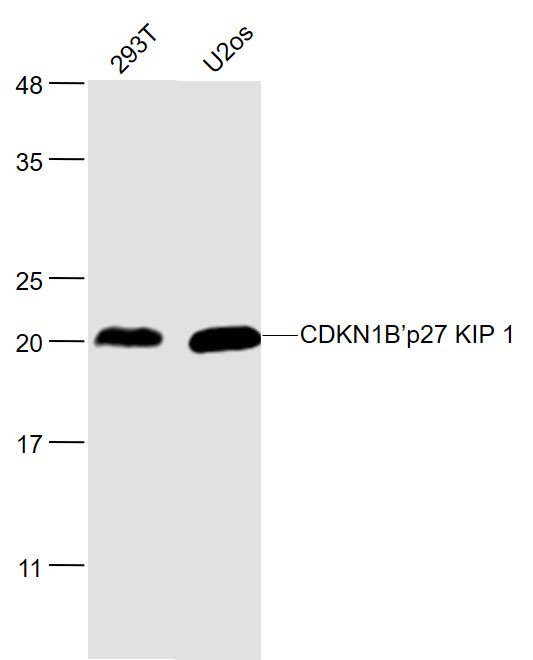 Lane 1: 293T cell lysates; Lane 2: U2os cell lysates probed with CDKN1B Polyclonal Antibody, Unconjugated (bs-0742R) at 1:1000 dilution and 4˚C overnight incubation. Followed by conjugated secondary antibody incubation at 1:20000 for 60 min at 37˚C.