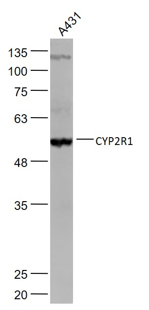 Lane 1: A431 cell lysates probed with CYP2R1 Polyclonal Antibody, Unconjugated (bs-3900R) at 1:1000 dilution and 4˚C overnight incubation. Followed by conjugated secondary antibody incubation at 1:20000 for 60 min at 37˚C.