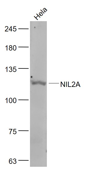 Hela cell lysates probed with ZEB Polyclonal Antibody, Unconjugated (bs-4187R) at 1:1000 dilution and 4˚C overnight incubation. Followed by conjugated secondary antibody incubation at 1:20000 for 60 min at 37˚C. Hela cell lysates probed with ZEB Polyclonal Antibody, Unconjugated (bs-4187R) at 1:1000 dilution and 4˚C overnight incubation. Followed by conjugated secondary antibody incubation at 1:20000 for 60 min at 37˚C.