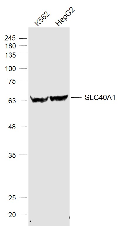 Lane 1: K562 cell lysates; Lane 2: HepG2 cell lysates probed with SLC40A1 Polyclonal Antibody, Unconjugated (bs-4906R) at 1:1000 dilution and 4˚C overnight incubation. Followed by conjugated secondary antibody incubation at 1:20000 for 60 min at 37˚C. Lane 1: K562 cell lysates; Lane 2: HepG2 cell lysates probed with SLC40A1 Polyclonal Antibody, Unconjugated (bs-4906R) at 1:1000 dilution and 4˚C overnight incubation. Followed by conjugated secondary antibody incubation at 1:20000 for 60 min at 37˚C.